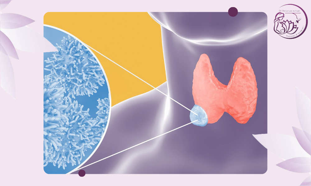چرا FNA برای تشخیص تیروئید انتخاب می‌شود؟
