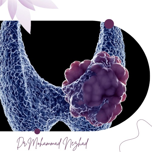 محدودیتهای Thyroid FNAB محدودیتهای Thyroid FNAB