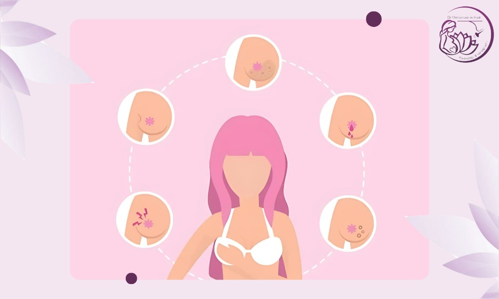 خطرات بیوپسی سینه خطرات بیوپسی سینه