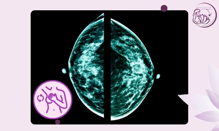 تفاوت ماموگرافی و سونوگرافی پستان