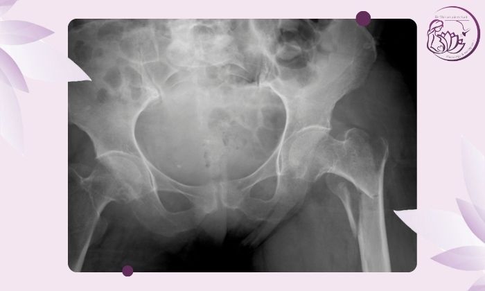 آمادگی‌های قبل از عکس ساده لگن