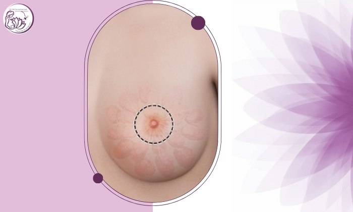 آیا تغییر رنگ نوک پستان می‌تواند نشانه بیماری باشد؟