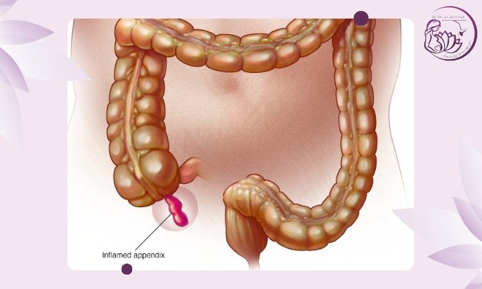 آیا اولتراسوند برای همه کافی است؟