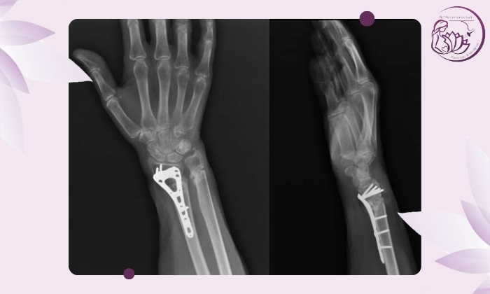 راه‌های درمان