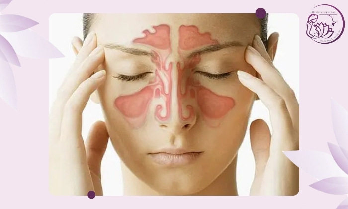 سایر روش‌های تشخیص سینوزیت