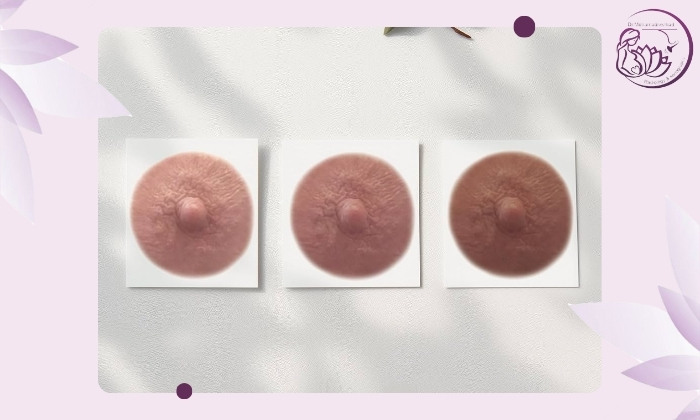 علت تغییر رنگ نوک پستان