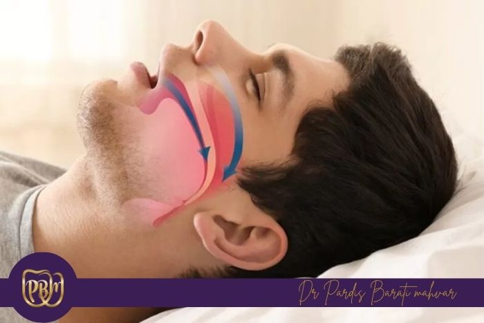 علت تنفس دهانی در خواب