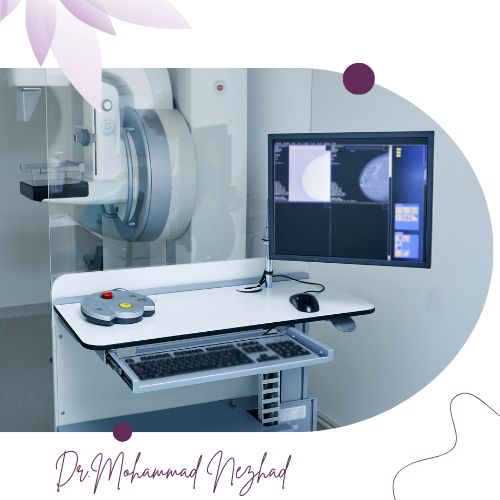 مزایای ماموگرافی دیجیتال