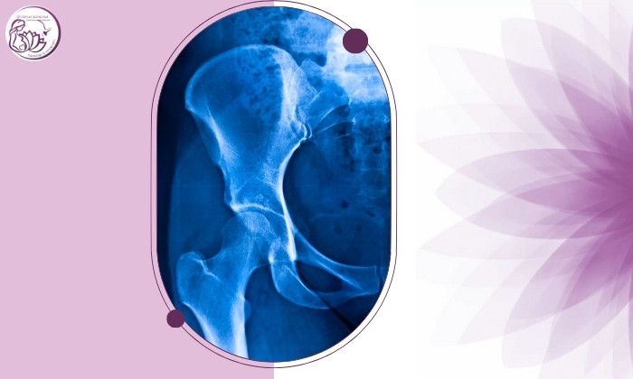 چطور برای عکس ساده لگن آماده شویم؟ راهنمای بیماران