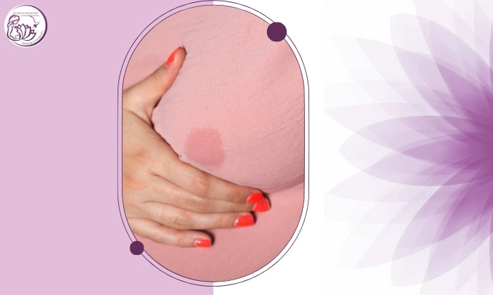 چه زمانی باید برای بررسی ترشحات پستان به پزشک مراجعه کنیم؟