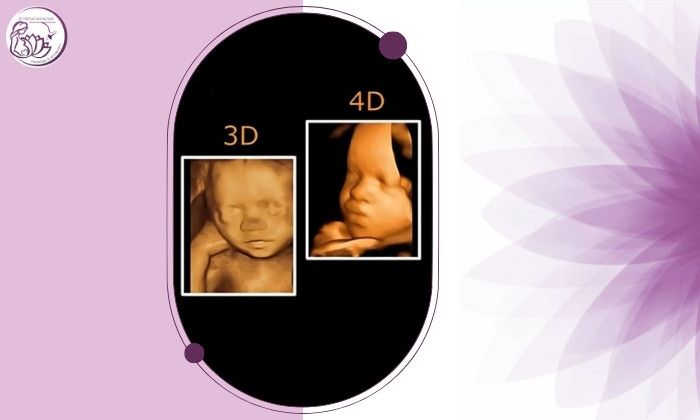 علائم جفت آکرتا چیست و از چه ماهی مشخص می‌شود؟